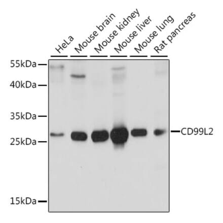 Western Blot - Anti-CD99L2 Antibody (A89079) - Antibodies.com