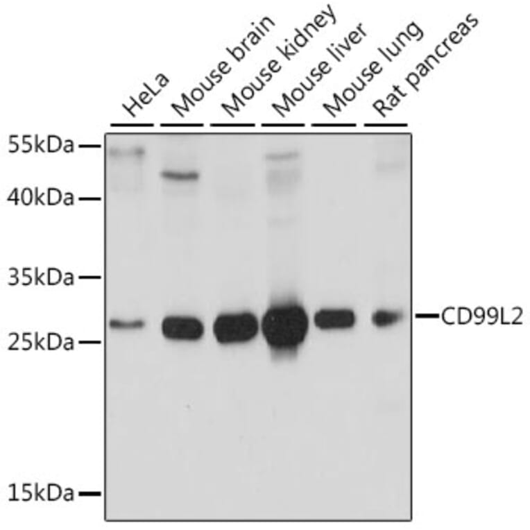 Western Blot - Anti-CD99L2 Antibody (A89079) - Antibodies.com