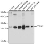 Western Blot - Anti-CD99L2 Antibody (A89079) - Antibodies.com
