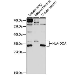 Western Blot - Anti-HLA-DOA Antibody (A89080) - Antibodies.com