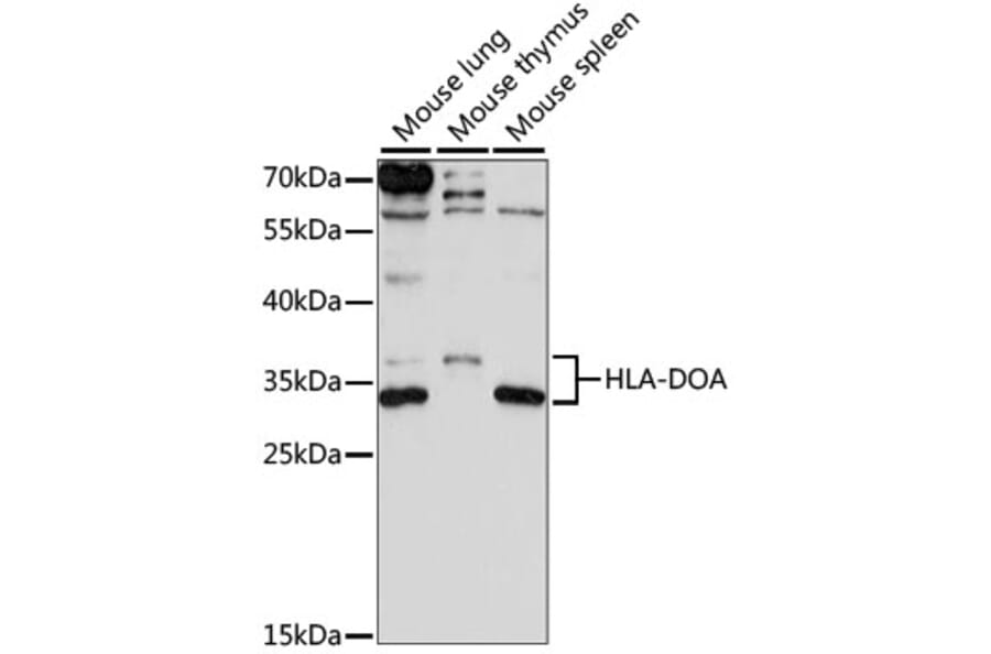 Western Blot - Anti-HLA-DOA Antibody (A89080) - Antibodies.com