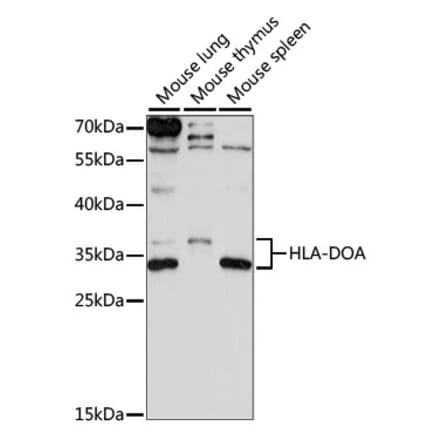 Western Blot - Anti-HLA-DOA Antibody (A89080) - Antibodies.com