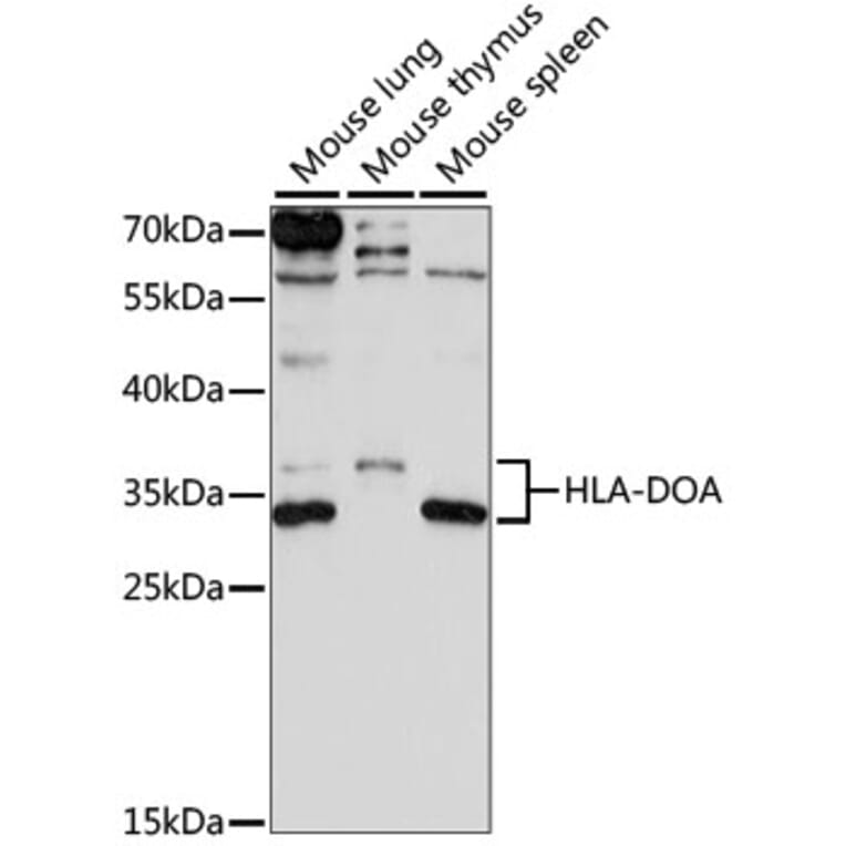 Western Blot - Anti-HLA-DOA Antibody (A89080) - Antibodies.com