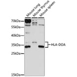 Western Blot - Anti-HLA-DOA Antibody (A89080) - Antibodies.com