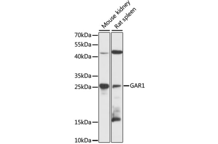 Western Blot - Anti-NOLA1 Antibody (A89082) - Antibodies.com