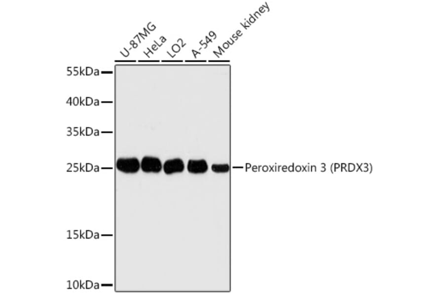 Western Blot - Anti-Peroxiredoxin 3/PRDX3 Antibody (A89084) - Antibodies.com