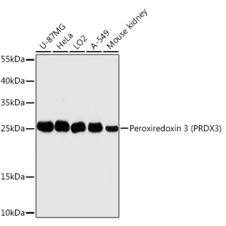 Western Blot - Anti-Peroxiredoxin 3/PRDX3 Antibody (A89084) - Antibodies.com
