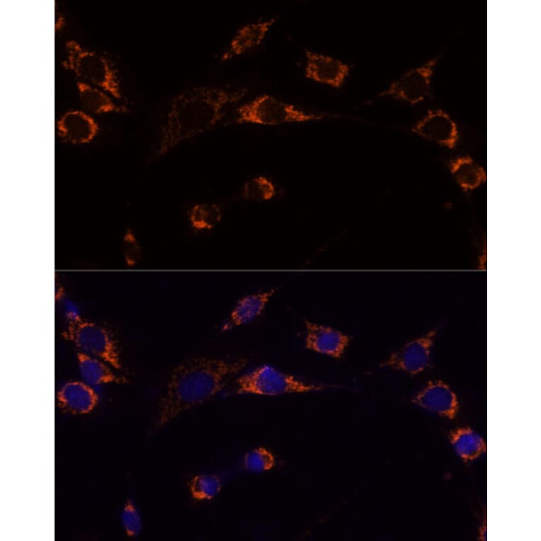 Immunofluorescence - Anti-Peroxiredoxin 3/PRDX3 Antibody (A89084) - Antibodies.com