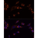 Immunofluorescence - Anti-Peroxiredoxin 3/PRDX3 Antibody (A89084) - Antibodies.com