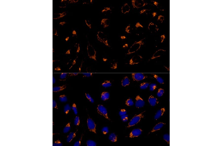 Immunofluorescence - Anti-Peroxiredoxin 3/PRDX3 Antibody (A89084) - Antibodies.com