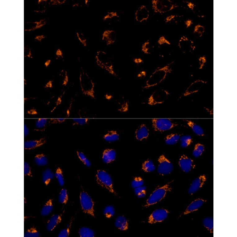Immunofluorescence - Anti-Peroxiredoxin 3/PRDX3 Antibody (A89084) - Antibodies.com