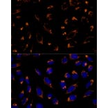 Immunofluorescence - Anti-Peroxiredoxin 3/PRDX3 Antibody (A89084) - Antibodies.com