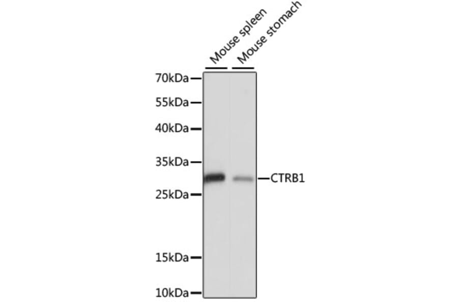Western Blot - Anti-CTRB1 Antibody (A89085) - Antibodies.com