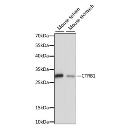 Western Blot - Anti-CTRB1 Antibody (A89085) - Antibodies.com