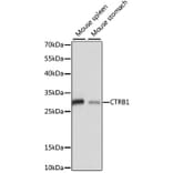 Western Blot - Anti-CTRB1 Antibody (A89085) - Antibodies.com