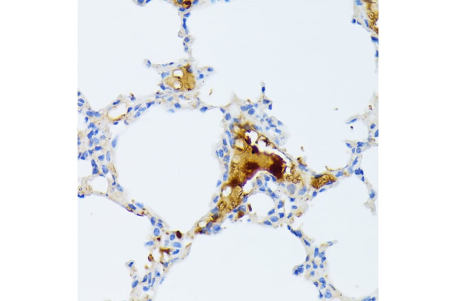 Immunohistochemistry - Anti-CTRB1 Antibody (A89085) - Antibodies.com