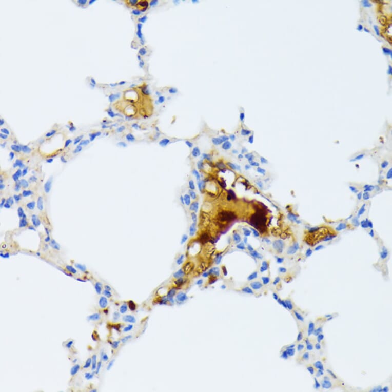 Immunohistochemistry - Anti-CTRB1 Antibody (A89085) - Antibodies.com