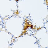 Immunohistochemistry - Anti-CTRB1 Antibody (A89085) - Antibodies.com