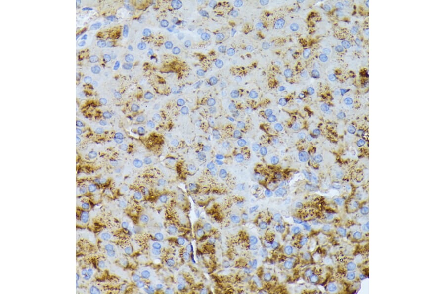Immunohistochemistry - Anti-CTRB1 Antibody (A89085) - Antibodies.com