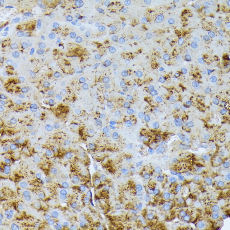 Immunohistochemistry - Anti-CTRB1 Antibody (A89085) - Antibodies.com