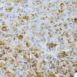 Immunohistochemistry - Anti-CTRB1 Antibody (A89085) - Antibodies.com