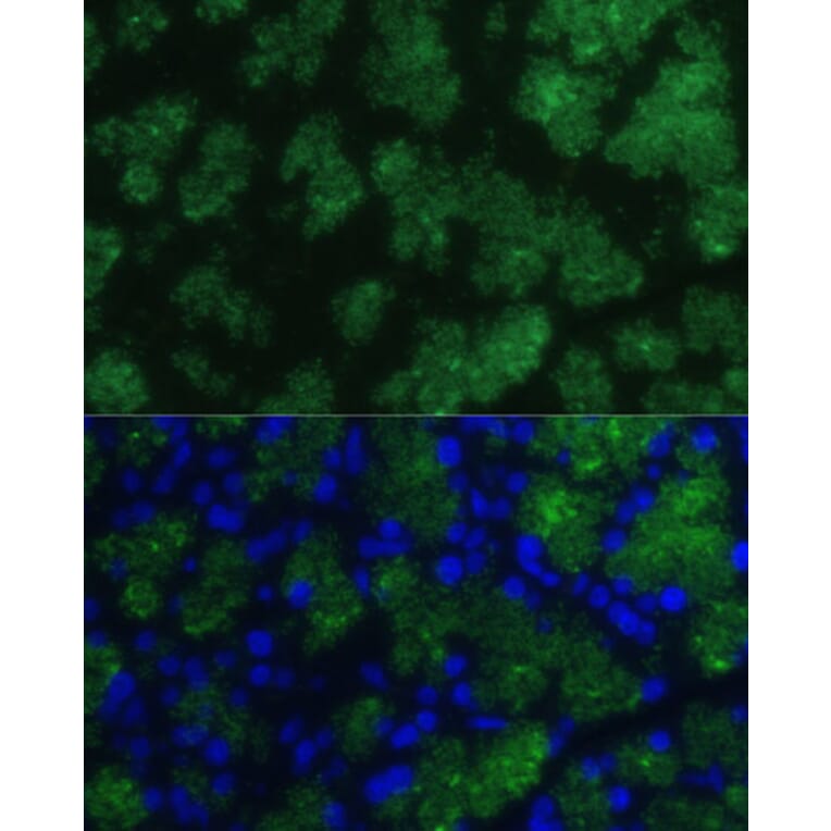 Immunofluorescence - Anti-CTRB1 Antibody (A89085) - Antibodies.com