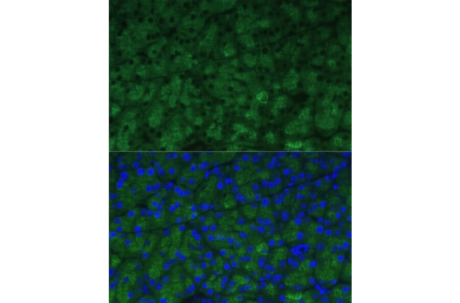 Immunofluorescence - Anti-CTRB1 Antibody (A89085) - Antibodies.com