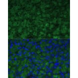 Immunofluorescence - Anti-CTRB1 Antibody (A89085) - Antibodies.com