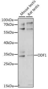 Western blot analysis of extracts of various cell lines, using Anti-ODF1 Antibody (A16023) at 1:1,000 dilution.
Secondary antibody: Goat Anti-Rabbit IgG (H+L) (HRP) (AS014) at 1:10,000 dilution.
Lysates / proteins: 25µg per lane.
Blocking buffer: 3% non-fat dry milk in TBST.
Detection: ECL Basic Kit (RM00020).
Exposure time: 30s.