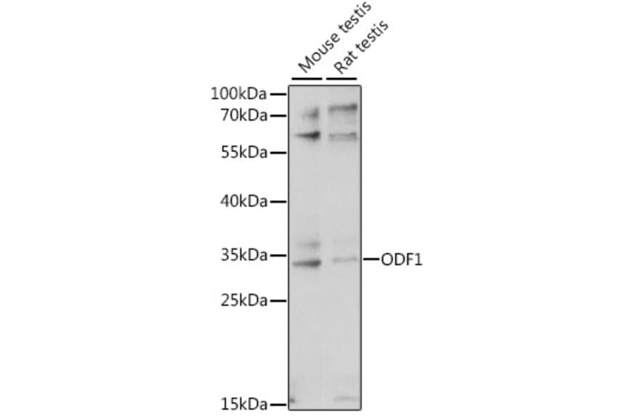 Western Blot - Anti-ODF1 Antibody (A89086) - Antibodies.com