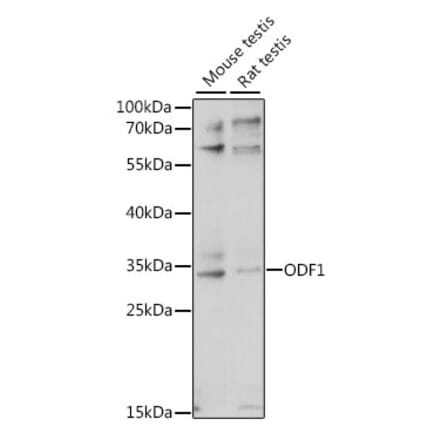 Western Blot - Anti-ODF1 Antibody (A89086) - Antibodies.com