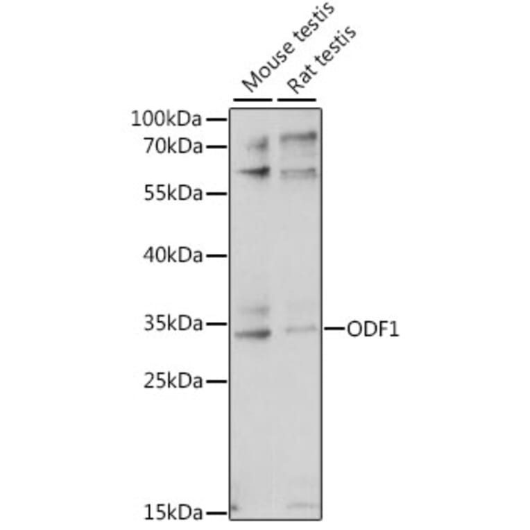 Western Blot - Anti-ODF1 Antibody (A89086) - Antibodies.com