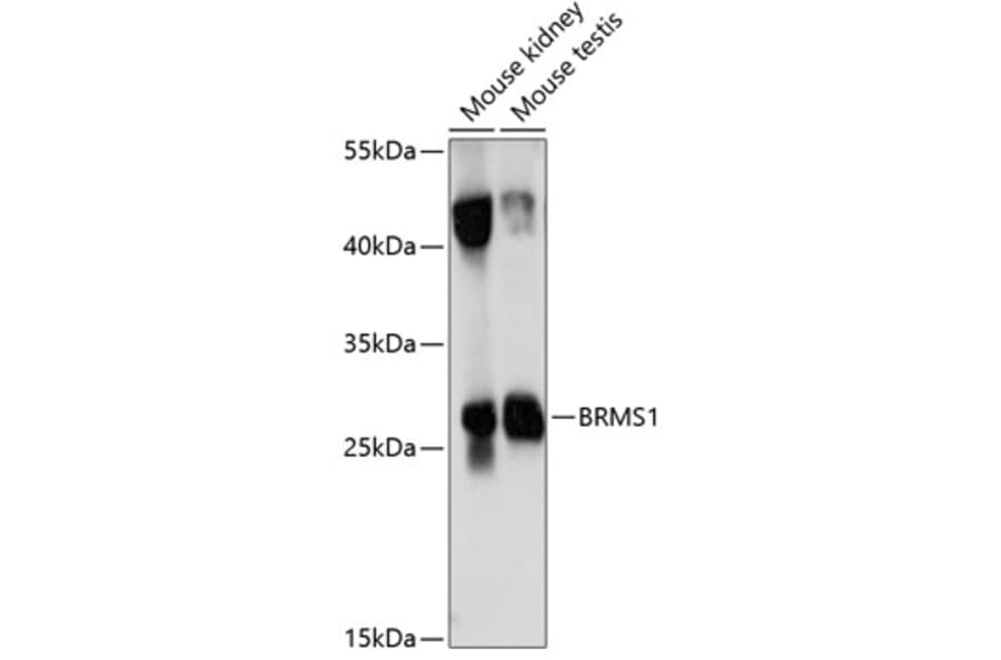 Western Blot - Anti-BRMS1 Antibody (A89087) - Antibodies.com