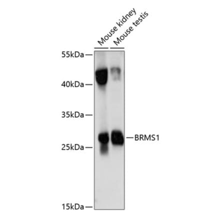 Western Blot - Anti-BRMS1 Antibody (A89087) - Antibodies.com