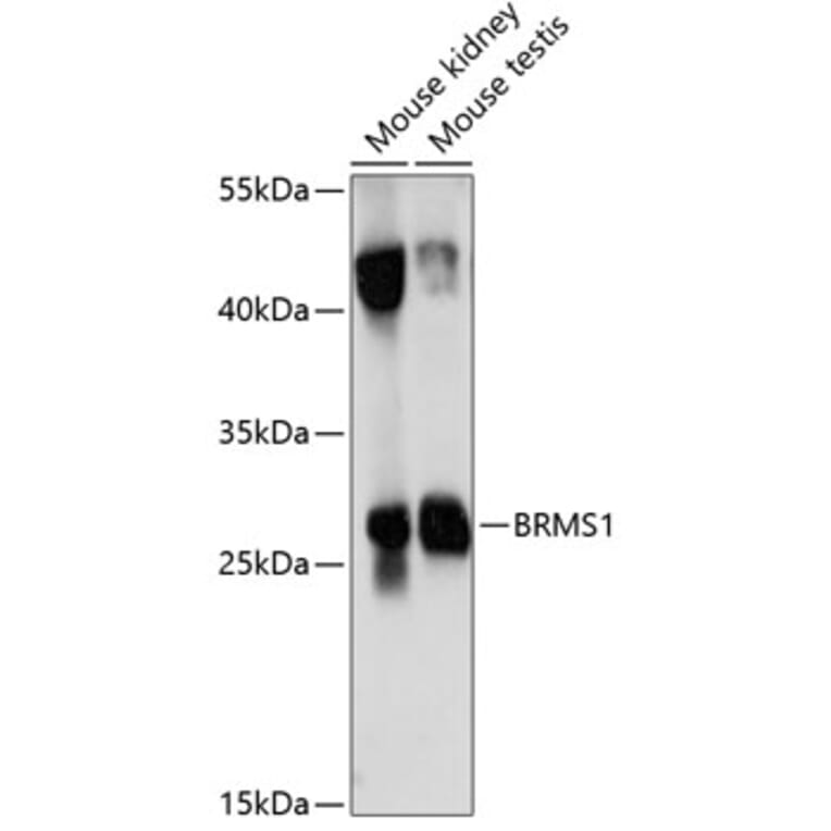 Western Blot - Anti-BRMS1 Antibody (A89087) - Antibodies.com