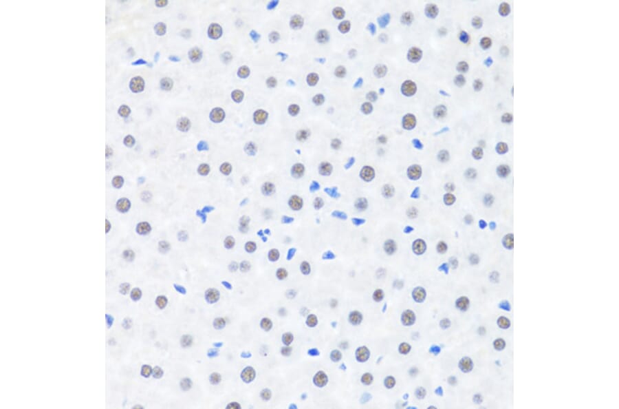 Immunohistochemistry - Anti-BRMS1 Antibody (A89087) - Antibodies.com