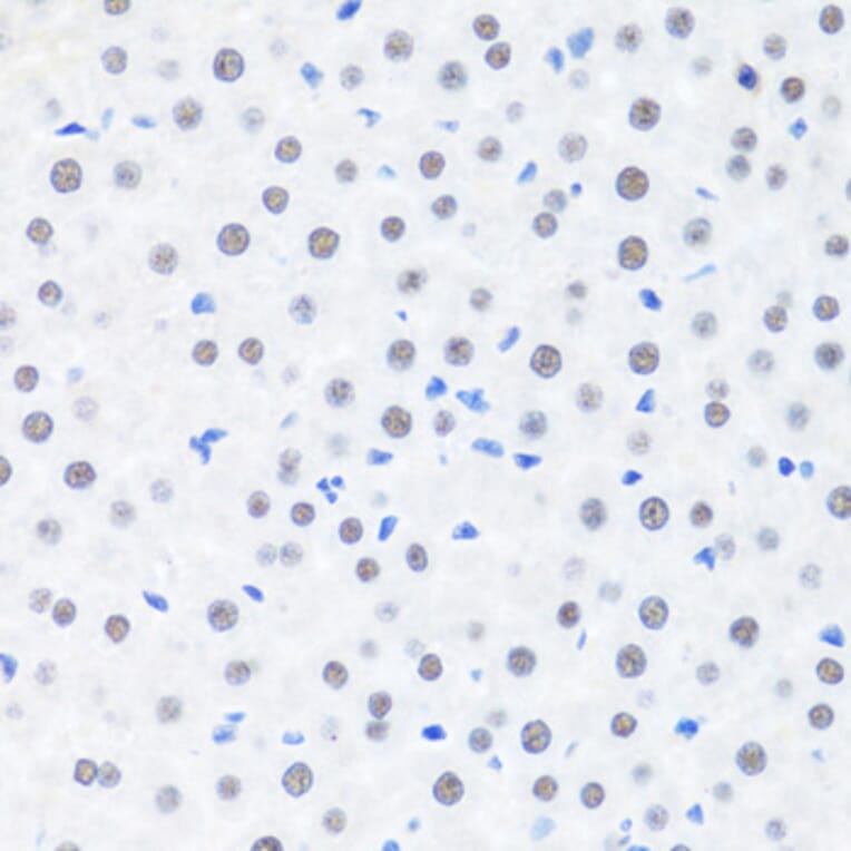 Immunohistochemistry - Anti-BRMS1 Antibody (A89087) - Antibodies.com