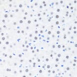 Immunohistochemistry - Anti-BRMS1 Antibody (A89087) - Antibodies.com