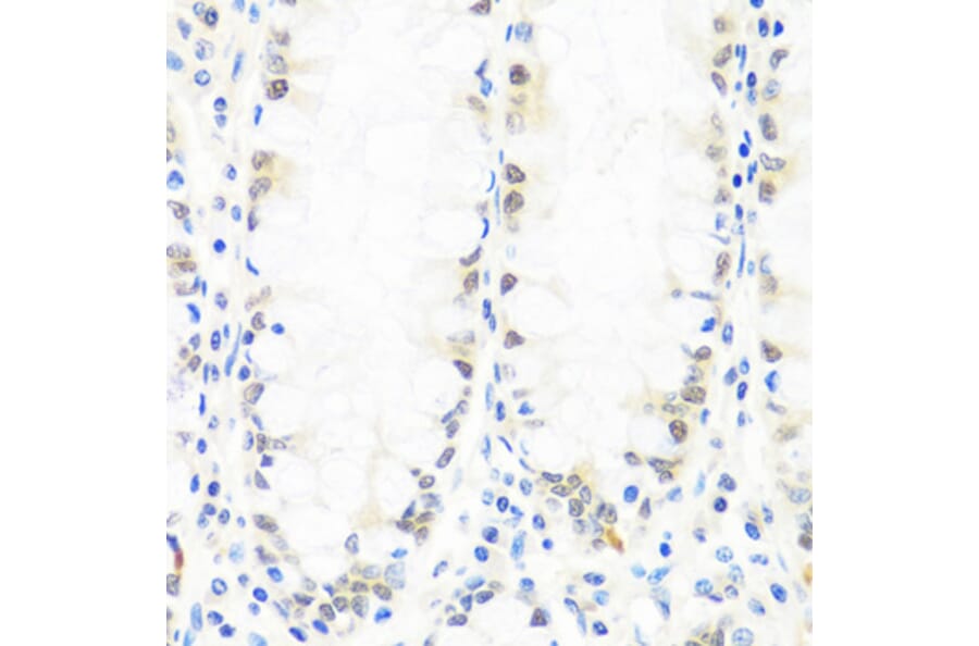 Immunohistochemistry - Anti-BRMS1 Antibody (A89087) - Antibodies.com