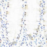 Immunohistochemistry - Anti-BRMS1 Antibody (A89087) - Antibodies.com