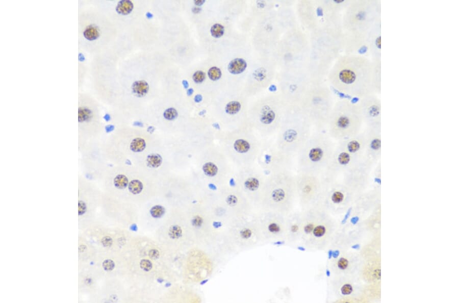 Immunohistochemistry - Anti-BRMS1 Antibody (A89087) - Antibodies.com