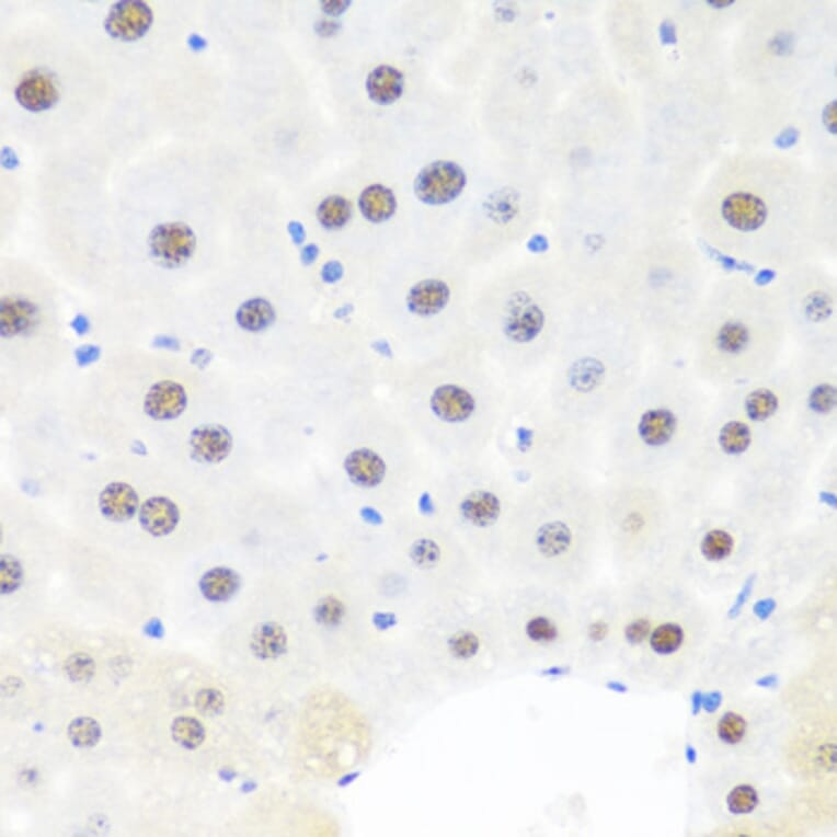 Immunohistochemistry - Anti-BRMS1 Antibody (A89087) - Antibodies.com