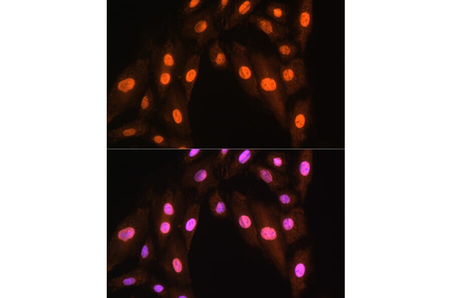Immunofluorescence - Anti-BRMS1 Antibody (A89087) - Antibodies.com