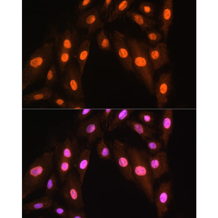 Immunofluorescence - Anti-BRMS1 Antibody (A89087) - Antibodies.com