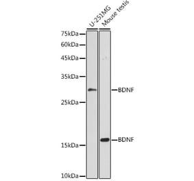 Western Blot - Anti-BDNF Antibody (A89088) - Antibodies.com