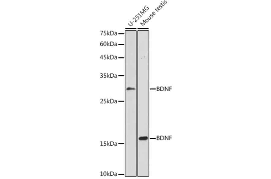 Western Blot - Anti-BDNF Antibody (A89088) - Antibodies.com