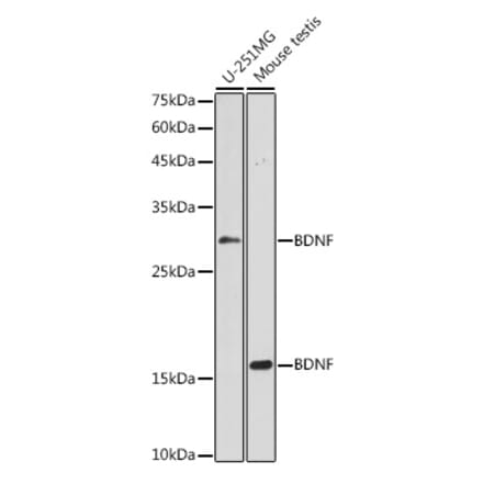 Western Blot - Anti-BDNF Antibody (A89088) - Antibodies.com