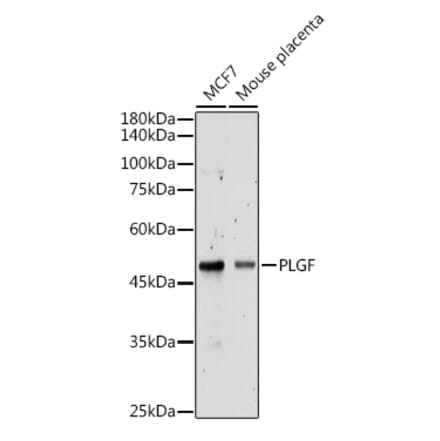 Western Blot - Anti-PLGF Antibody (A89089) - Antibodies.com