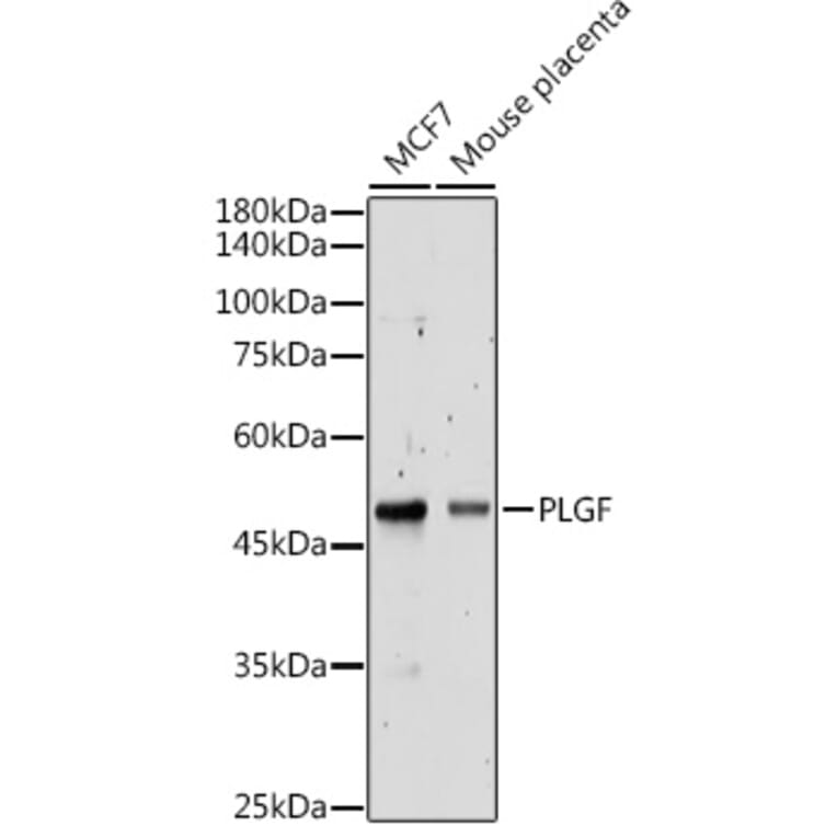 Western Blot - Anti-PLGF Antibody (A89089) - Antibodies.com