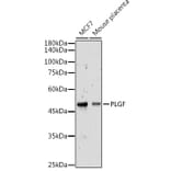 Western Blot - Anti-PLGF Antibody (A89089) - Antibodies.com